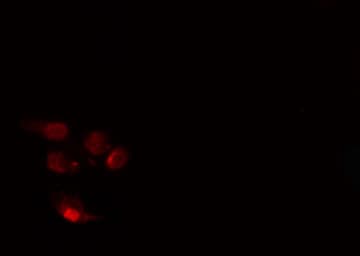 ARNT / HIF-1-Beta Antibody