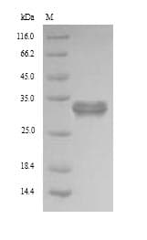Human PDXP / Pyridoxal Phosphatase Protein (Recombinant 6His, N-terminus)