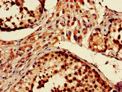 Polyclonal Rabbit anti-Human PARK2 / Parkin 2 Antibody (aa1-465)