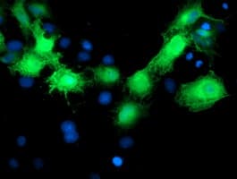 MVK Antibody (clone OTI 1D7, Carrier-free)