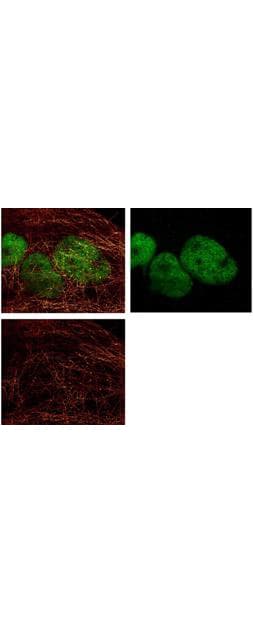 IHC-plus™ HDAC1 Antibody (aa450-482)