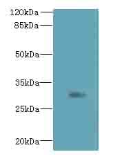 ZDHHC12 Antibody