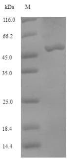 Cow MTHFD2 Protein (Recombinant 6His-SUMO, N-terminus)