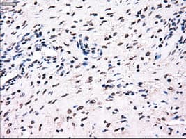 BRAF / B-Raf Antibody (clone OTI3A7)