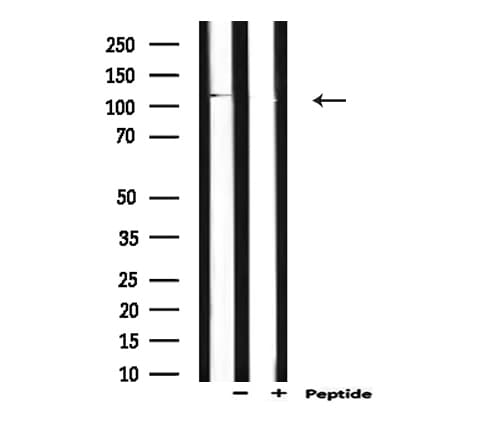 Polyclonal Rabbit anti-Human CDH1 / E Cadherin Antibody (IHC, IF, WB)