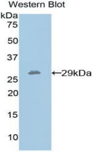 PTPRS Antibody (aa889-1102)