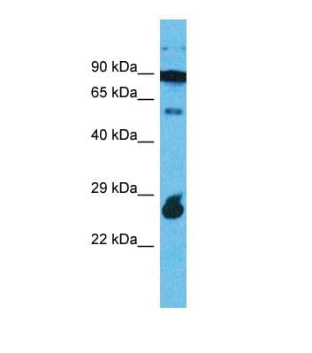 RAPGEFL1 Antibody (aa389-438)