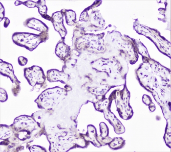 Polyclonal Rabbit anti-Human CTTN / Cortactin Antibody (IHC, IF, WB)