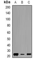 Polyclonal Rabbit anti-Human Geminin Antibody (IHC, WB)