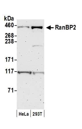 IHC-plus™ RANBP2 / TRP1 Antibody (aa1050-1100)