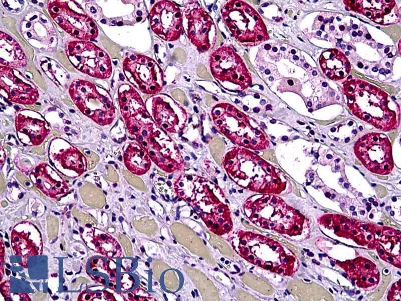 IHC-plus™ DHX9 Antibody (clone 3G7)