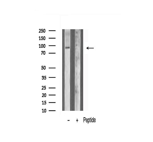 Polyclonal Rabbit anti-Human ANO9 / TMEM16J Antibody (IHC, IF, WB)