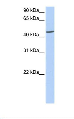 ICA69 / ICA1 Antibody (C-Terminus)