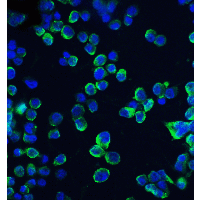 Polyclonal Rabbit anti-Human CLDN1 / Claudin 1 Antibody (IF, WB)