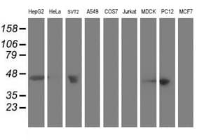 ACY1 / Aminoacylase 1 Antibody (clone OTI1B12)