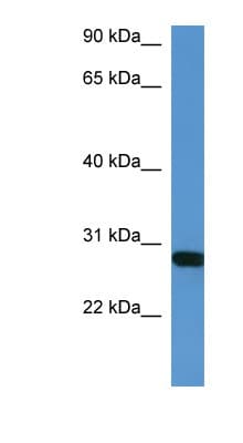 Polyclonal Rabbit anti-Mouse HOXB1 Antibody (C-Terminus, WB)