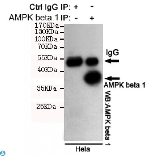 Monoclonal Mouse anti-Human PRKAB1 / AMPK Beta 1 Antibody (WB)