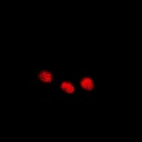 Polyclonal Rabbit anti-Human INTS10 Antibody (IF, WB)