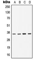 CD1B Antibody (Internal)