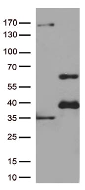 GATA3 Antibody (aa155-443, clone UMAB218)