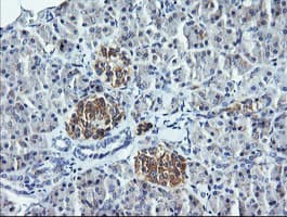 DNM1L / DRP1 Antibody (clone OTI3F4)