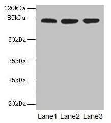 CENTB1 / ACAP1 Antibody