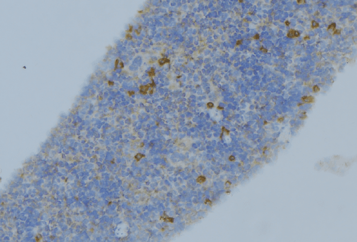 SERPINA1 / Alpha 1 Antitrypsin Antibody