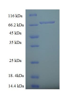 Human ZNF212 Protein (Recombinant His-SUMO)
