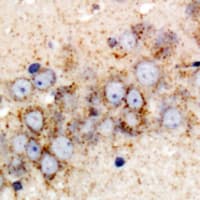 GPI Antibody