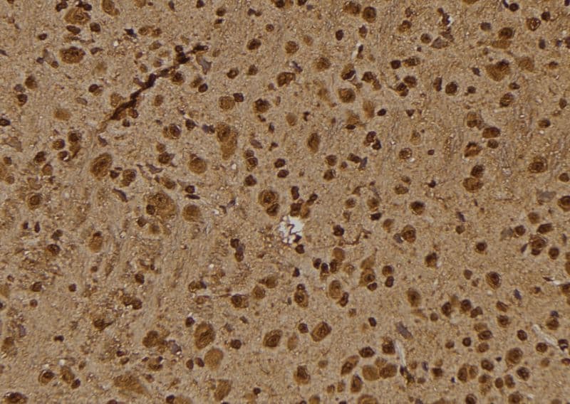 IRS1 Antibody