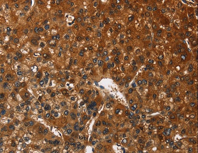 Polyclonal Rabbit anti-Human CATSPER4 Antibody (IHC)