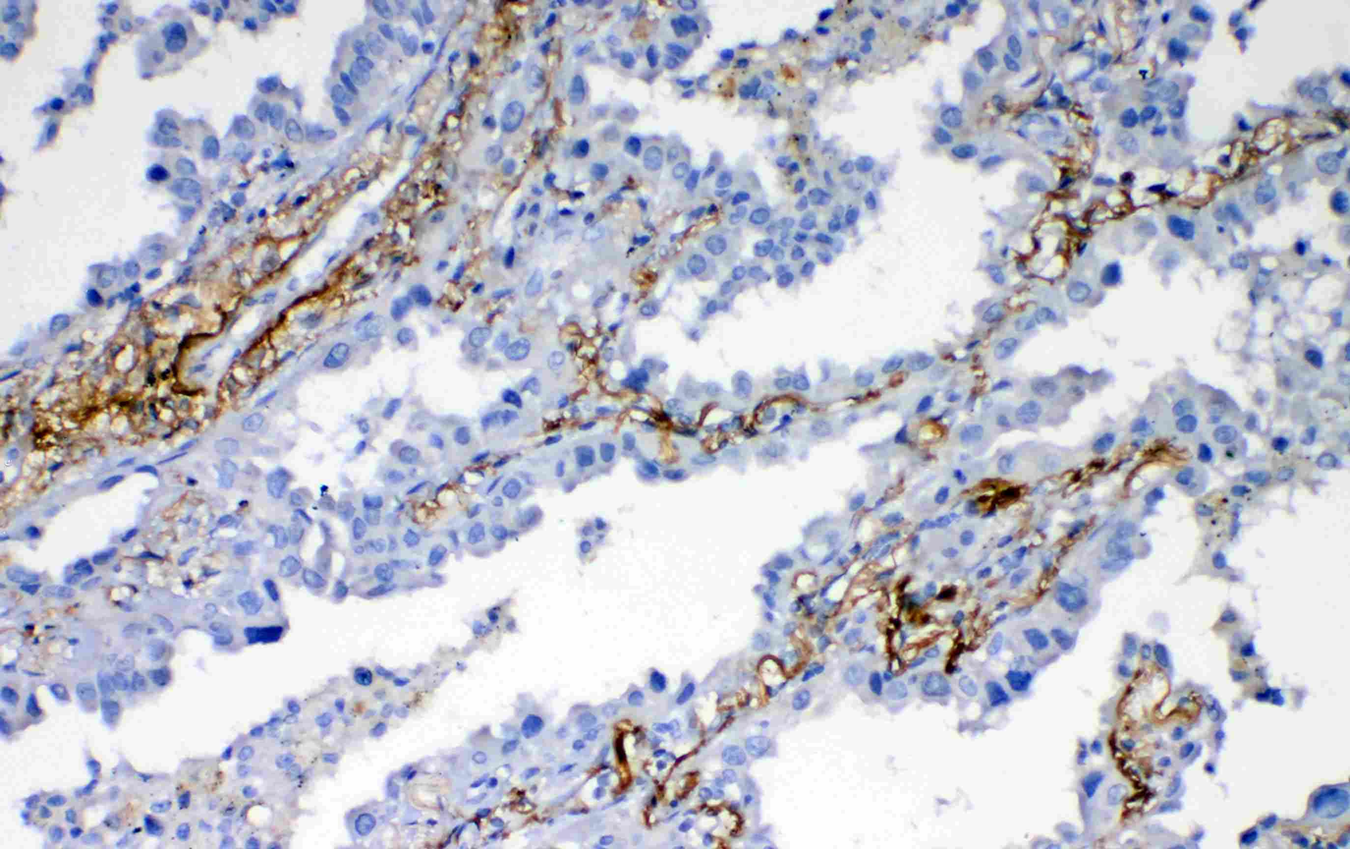 VEGFD Antibody (aa89-205)