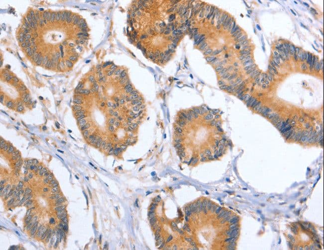 BLNK Antibody