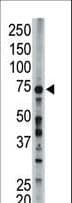 ACSL6 Antibody (aa240-270)