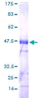 Human TCL / RHOJ Protein (Recombinant GST)