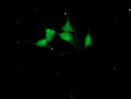 CST4 / Cystatin S Antibody (clone OTI2H10)