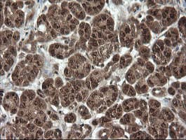 OTUB1 / OTU1 Antibody (clone OTI5F7)