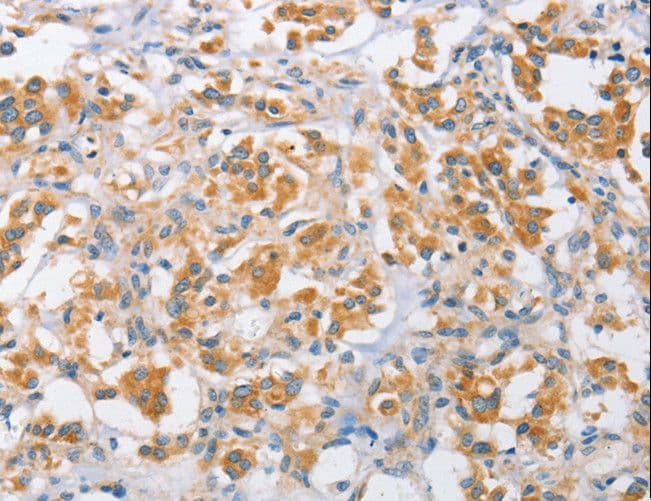ARMCX1 Antibody