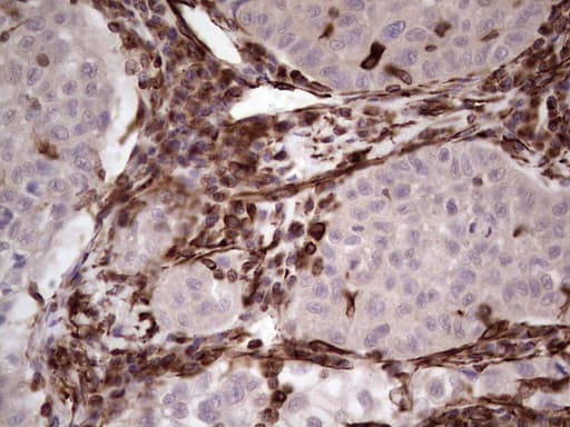 Peripherin Antibody (clone OTI1E10)