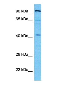 ALDOB Antibody (N-Terminus)