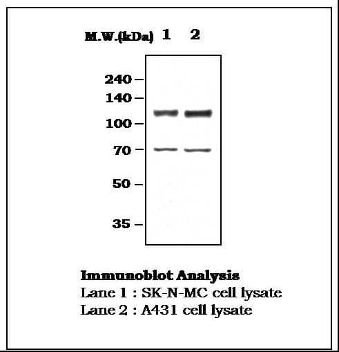IHC-plus™ FAK / Focal Adhesion Kinase Antibody (aa706-1052)