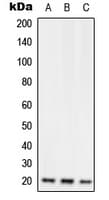 Polyclonal Rabbit anti-Human RGS10 Antibody (Internal, IHC, WB)