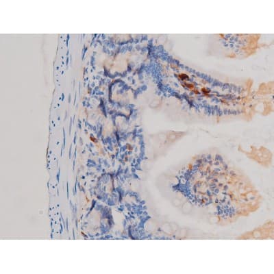 CDC25A Antibody (phospho-Ser75)