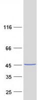 Human TNNT2 / CTNT Protein (Recombinant Myc-DDK (Flag))