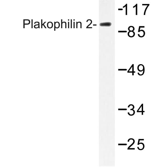 PKP2 / Plakophilin 2 Antibody (Pro663)