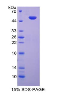 Human TLR10 Protein (Recombinant His-GST)