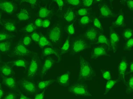IHC-plus™ LIG3 / DNA Ligase III Antibody