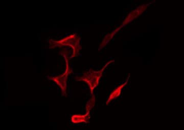EGFR Antibody (phospho-Ser1071)
