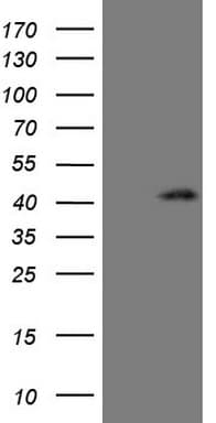 CTGF Antibody (aa27-349, clone OTI6D1)