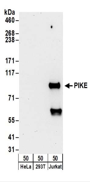 AGAP2 / PIKE Antibody (aa450-500)